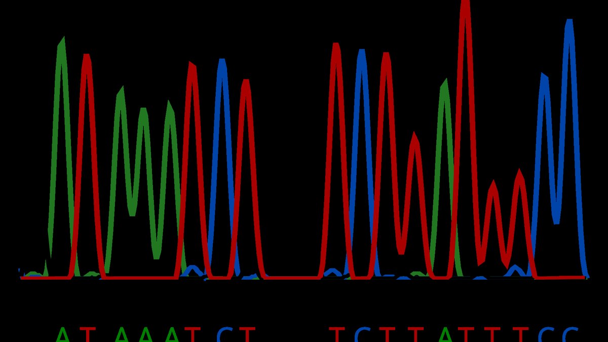 A Sanger DNA sequencing chromatogram trace in green, red and blue peaks — the read-out of the individual variation that replaced racial typology, a Panacea Bio Chem review by Bogdan Dicoias