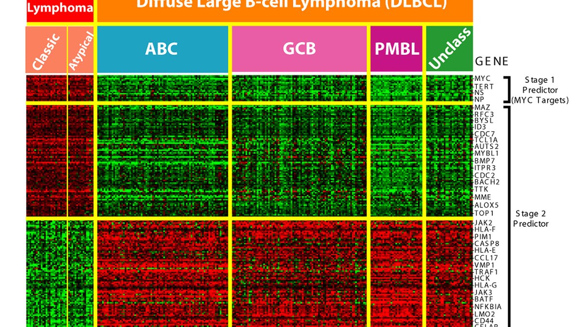 A DNA microarray gene-expression heatmap in red and green — the high-throughput genomics that reads many loci at once for population and pharmacogenomic studies, a Panacea Bio Chem review by Bogdan Dicoias